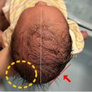 장두 | [육아 기록] 니노필로우 두상베개 | 신생아부터 시작하는 두상관리 (feat. 장두형 아기)