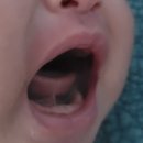 38-D | D+38 설소대 수술 후기, 단둘이 첫 외출, 닥터브라운 내로우넥