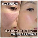 로데오사우나 | 압구정로데오 청담피부과 울트라클리어 효과 솔직 후기, 직접 느낀 다운타임과 가격 비교