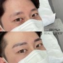 점촌4길 | 반응 좋았던 울산남자반영구눈썹문신 잘하는곳 방문후기