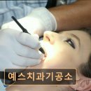 예스치과기공소 이미지