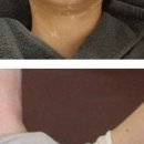 미고 테라피 이미지