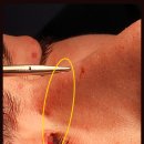 강남서연성형외과의원 이미지