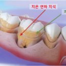 센트럴치과 이미지
