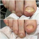 아카데미빌딩 관리사무소 | [바바뷰티 아카데미] 대구 화원 무좀발톱 내성발톱치료 전문관리샵 토탈뷰티샵 리얼후기