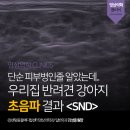 우리SND 이미지