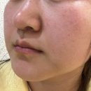 포차천국안산원곡점 | 스무살에 머물다 안산피부관리샵에서 관리받은 후기