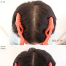 압구정더모의원 이미지