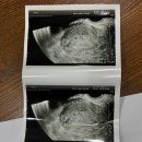 구로-공단-구로-856 | 나의 두 번째 임신일기 임산부 훠궈 먹어도 될까 광명 훠궈맛집 건강보험공단 임신 종결 바우처 재발급