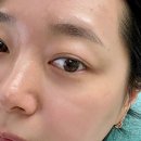 마포구 피부관리 시유룸 스킨플래닝 후기