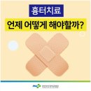 흉터 치료, 언제 어떻게 해야 할까요? 이미지