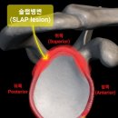 안바핏