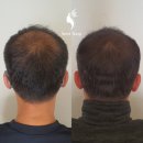 새로이숲부평 이미지