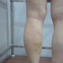 전외과의원 네이버블로그
