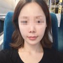 미모드림의원 | 천호동 팔자필러 찐맛집 미모드림의원