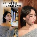포,제이 | 20대 후반 중안부 실리프팅 후기 | 제이앤성형외과 포웨이실리프팅 (내돈내산)