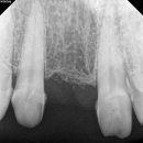 퍼펙트치과기공소 이미지