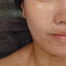 퓨어스킨앤바디 이미지