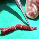 젠메디칼 이미지