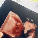 문현주산부인과 이미지