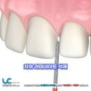 그리치과기공소 이미지