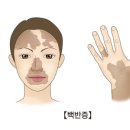 하얀 이미지