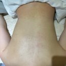 청천한의원 | [군포 당정동] 뻐근한 등 관리/ 셀룰라이트 관리는 가꾸는 동안 군포당정점 추천!