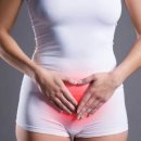 플라베스 이미지