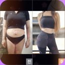 스타메디타워 | 부천복부주사 합리적인 복부람스 가격과 후기는