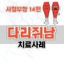 동의보감자동차 | 사혈부항 14편: 자다가 종아리쥐 딱 그 자리 피 뺐더니 멈췄어요