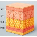 다산종합의원 | 다산리프팅, 울쎄라 잘하는 곳의 차이점은?