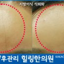 힐링한의원 이미지