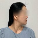 행복정비공장 | 안양 범계 내돈내산 풀페이스 리프팅 즉각 효과 1회차 추천 통증 부작용 후기