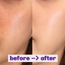 동아(아)제2경로당 | 멜라논크림 동아제약 기미관리 루틴 후기