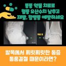 발가락 통풍으로 발작! 어떻게 해야 하죠? [연세편한마디내과]