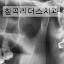 칠곡리더스치과의원 네이버블로그