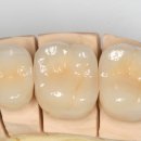 아름다운치과기공소 이미지