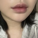 남양주입술필러 후기 이유 있는 내돈내산 재방문 + 한강뷰 드라이브 카페 추천