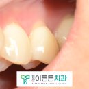 침산이튼튼치과 이미지