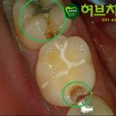 허브치과 티스토리