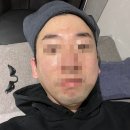 루카스코리아 | 왕십리피부과 | 슈링크효과 제대로 본 찐 후기