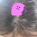 평촌고운세상피부과의원 | 두피에 갑자기 생긴 점 뭐지? 평촌 고운세상 진료 후기까지!