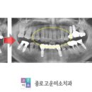 서울고운미소치과교정과치과의원 네이버블로그