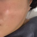 더마7 (DERMA7) | 더마7 합정 스피큘 관리 후기