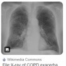 아주편안신경외과의원 | 대구초등학생맛집, 흑백요리사 정지선셰프 티엔미미 [서부통신경외과] 대명동, 송현동, 딤섬후기