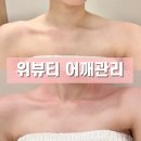 몸펴기 | 굽은어깨펴기 위뷰티 발로 하는 관리 발사지 승모근관리 후기