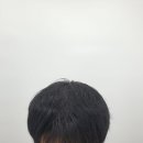 맨시크 | 남자 정수리 탈모 SMP두피문신 안양 맨시크 후기