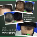 모디헤어플란트의원 이미지