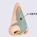 코비쥬 의원 | 비중격천공수술후기 기록 (1)천공발견 후 이비인후과의원 종합병원 서울대학병원진료까지 10곳 이상...