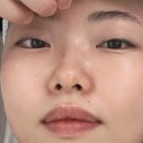 트로시에스테틱